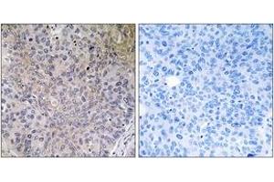 Immunohistochemistry (IHC) image for anti-NADH Dehydrogenase (Ubiquinone) Fe-S Protein 7, 20kDa (NADH-Coenzyme Q Reductase) (NDUFS7) (AA 164-213) antibody (ABIN2890440) (NDUFS7 抗体  (AA 164-213))