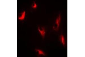 Immunofluorescent analysis of Thymidine Phosphorylase staining in A549 cells. (Thymidine Phosphorylase 抗体)