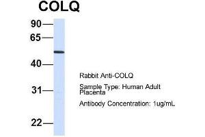 Host:  Rabbit  Target Name:  COLQ  Sample Type:  Human Adult Placenta  Antibody Dilution:  1. (COLQ 抗体  (N-Term))