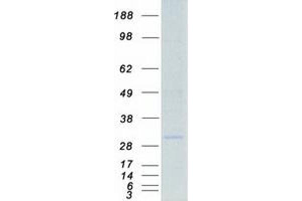 HLA-DQA1 Protein (Myc-DYKDDDDK Tag)