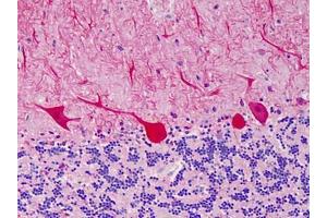 Human Cerebellum: Formalin-Fixed, Paraffin-Embedded (FFPE) (CARD11 抗体)