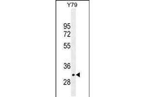 Western blot analysis in Y79 cell line lysates (35ug/lane). (LRRC46 抗体  (N-Term))