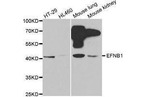 Western blot analysis of extracts of various cell lines, using EFNB1 antibody. (Ephrin B1 抗体  (AA 28-237))