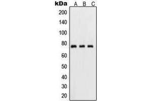 Western blot analysis of NF-kappaB p65 (pS311) expression in HeLa TNFa-treated (A), mouse kidney (B), PC12 UV-treated (C) whole cell lysates. (NF-kB p65 抗体  (pSer311))