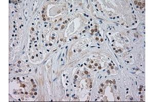 Immunohistochemistry (IHC) image for anti-Mitogen-Activated Protein Kinase 8 (MAPK8) (AA 1-384) antibody (ABIN1490768) (JNK 抗体  (AA 1-384))