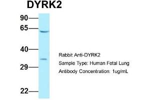 Host: Rabbit  Target Name: DYRK2  Sample Tissue: Human Fetal Lung  Antibody Dilution: 1. (DYRK2 抗体  (C-Term))