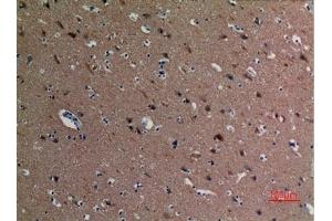 Immunohistochemical analysis of paraffin-embedded human-brain, antibody was diluted at 1:100. (alpha Tubulin 抗体  (acLys40))