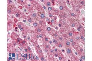ABIN334421 (5µg/ml) staining of paraffin embedded Human Liver. (HYAL1 抗体  (Internal Region))
