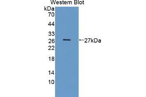 Detection of Recombinant DDC, Human using Polyclonal Antibody to Dopa Decarboxylase (DDC) (DDC 抗体  (AA 200-420))
