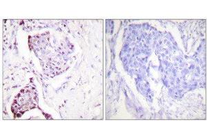 Immunohistochemistry (IHC) image for anti-Ubiquitin (Ubiquitin) (Internal Region) antibody (ABIN1848877) (Ubiquitin 抗体  (Internal Region))