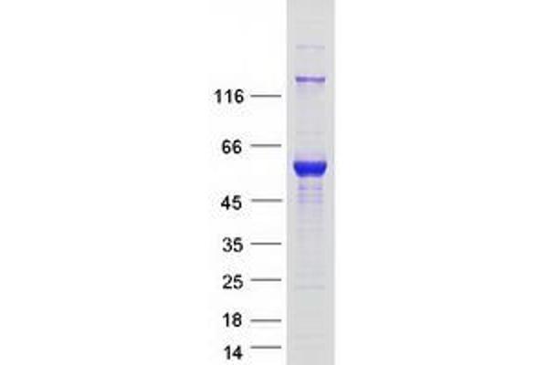 JMJD6 Protein (Transcript Variant 2) (Myc-DYKDDDDK Tag)