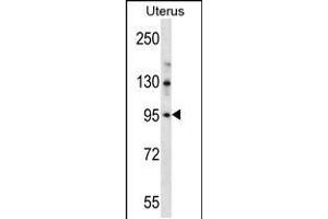 Western blot analysis in human normal Uterus tissue lysates (35ug/lane). (LRRC37B 抗体  (C-Term))