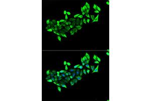Immunofluorescence analysis of HeLa cells using FLOT1 antibody (ABIN5973661). (Flotillin 1 抗体)