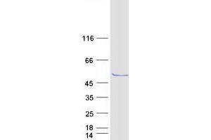 Validation with Western Blot (OXSM Protein (Transcript Variant 1) (Myc-DYKDDDDK Tag))