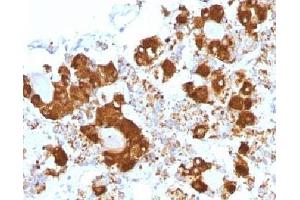 IHC testing of FFPE human pituitary gland with ACTH antibody (clone CLIP/1407). (CLIP 抗体  (AA 25-39))