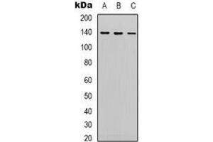Western blot analysis of HER2 expression in Hela (A), 293 (B), Jurkat (C) whole cell lysates. (ErbB2/Her2 抗体)