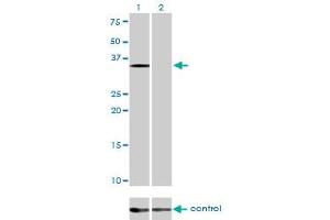 Western Blotting (WB) image for anti-Eukaryotic Translation Initiation Factor 2 Subunit 1 (EIF2S1) (AA 1-315) antibody (ABIN560711)