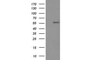 Western Blotting (WB) image for anti-Tumor Protein P53 (TP53) antibody (ABIN1499978) (p53 抗体)