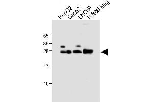 All lanes : Anti-GSTA1 Antibody at 1:4000 dilution Lane 1: HepG2 whole cell lysate Lane 2: Caco2 whole cell lysate Lane 3: LNCaP whole cell lysate Lane 4: Human fetal lung tissue lysate Lysates/proteins at 20 μg per lane. (GSTA1 抗体)