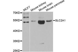 Western blot analysis of extracts of various cell lines, using SLC2A1 antibody. (GLUT1 抗体)