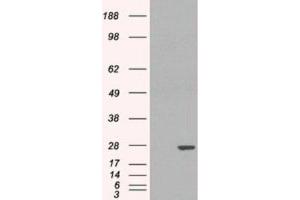Western Blotting (WB) image for anti-Glutathione S-Transferase pi 1 (GSTP1) (Internal Region) antibody (ABIN2465797) (GSTP1 抗体  (Internal Region))