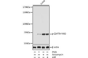 Western blot analysis of extracts of Jurkat cells using Phospho-ZAP70(Y493) Polyclonal Antibody at dilution of 1:5000. (ZAP70 抗体  (pTyr493))