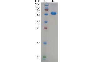 SDS-PAGE (SDS) image for SARS-CoV-2 Spike (B.1.617.2 - delta), (RBD) protein (Fc Tag) (ABIN7490659)