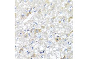 Immunohistochemistry of paraffin-embedded rat brain using INPP5K antibody at dilution of 1:100 (x40 lens). (INPP5K 抗体)