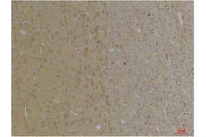 Immunohistochemistry (IHC) analysis of paraffin-embedded Rat Brain Tissue using KCNK4 (TRAAK) Rabbit Polyclonal Antibody diluted at 1:200. (KCNK4 抗体)
