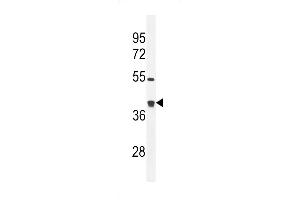 Western blot analysis in mouse bladder tissue lysates (35ug/lane). (GLRX3 抗体  (N-Term))