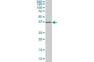 HSD17B1 monoclonal antibody (M03A), clone 2E5 Western Blot analysis of HSD17B1 expression in Jurkat . (HSD17B1 抗体  (AA 189-285))