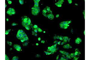 Anti-SORD mouse monoclonal antibody (ABIN2453676) immunofluorescent staining of COS7 cells transiently transfected by pCMV6-ENTRY SORD (RC200415). (SORD 抗体)