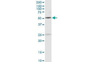 MBD1 monoclonal antibody (M05), clone 2B10. (MBD1 抗体  (AA 415-508))