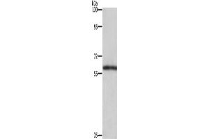 Western Blotting (WB) image for anti-T-Box 5 (TBX5) antibody (ABIN2434989) (T-Box 5 抗体)