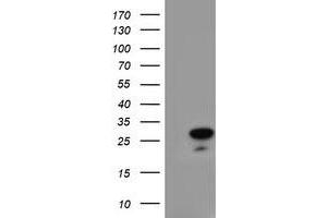 HEK293T cells were transfected with the pCMV6-ENTRY control (Left lane) or pCMV6-ENTRY RGS16 (Right lane) cDNA for 48 hrs and lysed. (RGS16 抗体)