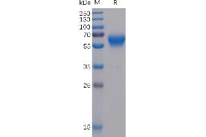 Human BTLA Protein, mFc-His Tag on SDS-PAGE under reducing condition. (BTLA Protein (AA 31-150) (mFc-His Tag))