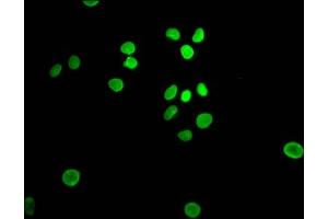 Immunofluorescence (IF) image for anti-E2F Transcription Factor 1 (E2F1) antibody (ABIN7127462)