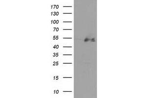 HEK293T cells were transfected with the pCMV6-ENTRY control (Left lane) or pCMV6-ENTRY HDAC1 (Right lane) cDNA for 48 hrs and lysed. (HDAC1 抗体)