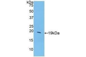 Detection of Recombinant GCSF, Porcine using Polyclonal Antibody to Colony Stimulating Factor 3, Granulocyte (GCSF) (G-CSF 抗体  (AA 34-193))