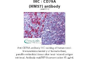 Image no. 1 for anti-B-cell antigen receptor complex-associated protein alpha chain (CD79A) (AA 202-216) antibody (ABIN1723567) (CD79a 抗体  (AA 202-216))