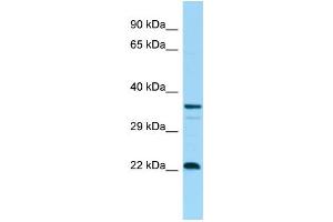WB Suggested Anti-CD83 Antibody Titration: 1. (CD83 抗体  (C-Term))