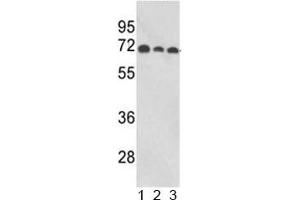 Western blot analysis of ABI1 antibody and human 1) MCF-7, 2) CEM, and 3) Jurkat lysate. (ABI1 抗体  (AA 81-108))