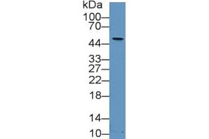 Western Blotting (WB) image for Matrix Metallopeptidase 13 (Collagenase 3) (MMP13) ELISA Kit (ABIN6720554)