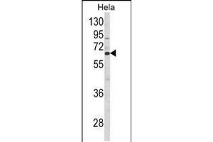 Western blot analysis of CTPS2 Antibody in Hela cell line lysates (35ug/lane) (CTPS2 抗体  (N-Term))