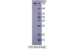 SDS-PAGE analysis of Human LSR Protein. (LSR 蛋白)