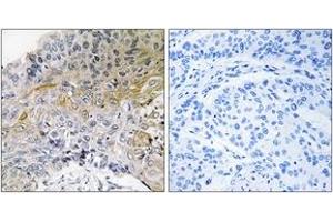 Immunohistochemistry (IHC) image for anti-Breast Cancer Anti-Estrogen Resistance 1 (BCAR1) (AA 376-425) antibody (ABIN2888602) (BCAR1 抗体  (AA 376-425))