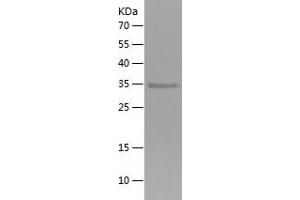 Western Blotting (WB) image for Leucine-Rich Repeat-Containing G Protein-Coupled Receptor 6 (LGR6) (AA 833-967) protein (His-IF2DI Tag) (ABIN7283624) (LGR6 Protein (AA 833-967) (His-IF2DI Tag))