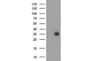 HEK293T cells were transfected with the pCMV6-ENTRY control (Left lane) or pCMV6-ENTRY VSIG2 (Right lane) cDNA for 48 hrs and lysed. (VSIG2 抗体)