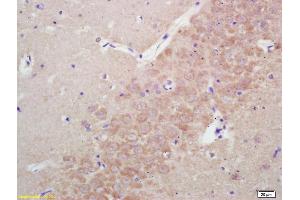 Formalin-fixed and paraffin embedded rat brain labeled with Rabbit Anti KIFC1 Polyclonal Antibody, Unconjugated (ABIN873143) at 1:200 followed by conjugation to the secondary antibody and DAB staining (KIFC1 抗体)