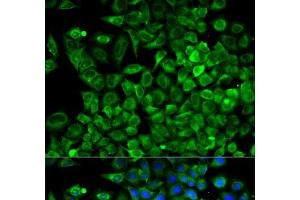 Immunofluorescence analysis of A549 cells using ALDOA Polyclonal Antibody (ALDOA 抗体)